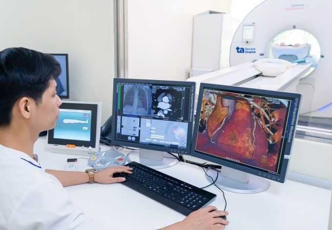 Đặt stent thông mạch vành tắc hẹp 90%