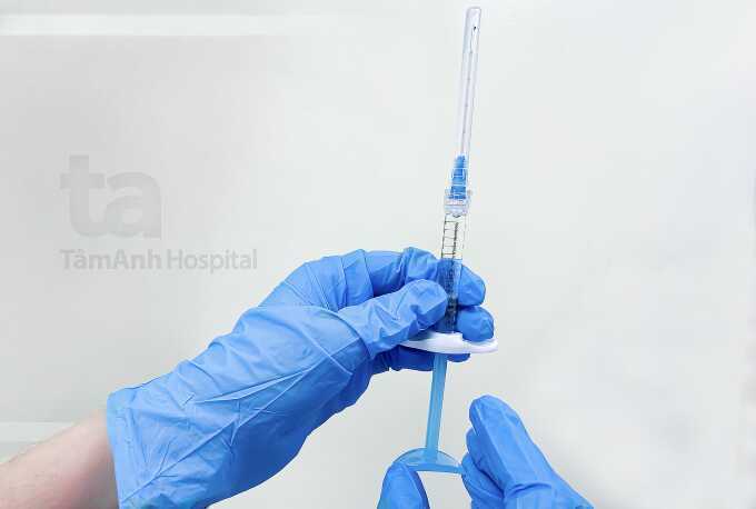 Đang niềng răng có tiêm filler được không?