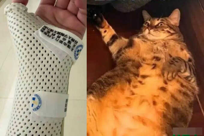 Bị mèo nặng 7,5 kg `đè` khi ngủ, cô gái gãy xương cổ tay