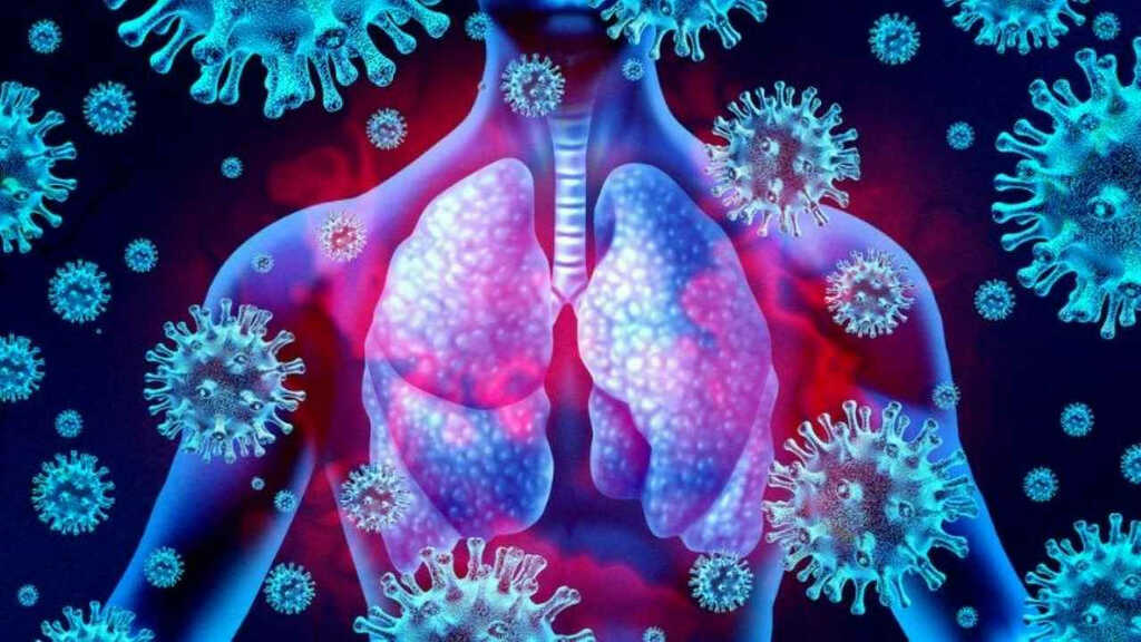 Virus `bị lãng quên` ở người lớn quay trở lại tấn công từ mũi đến phổi