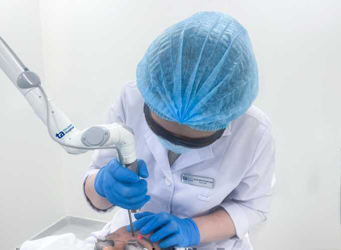 Dùng laser xóa xăm chân mày