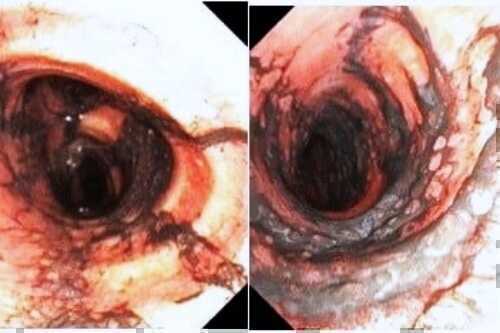 Vợ chồng ngạt khói, tổn thương đa cơ quan nguy kịch trong vụ cháy ở TPHCM