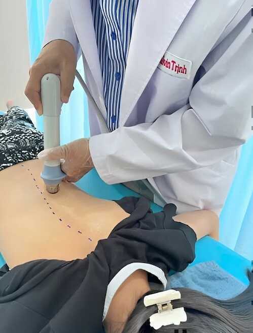 Vẹo cột sống vì tật `chân thấp chân cao`