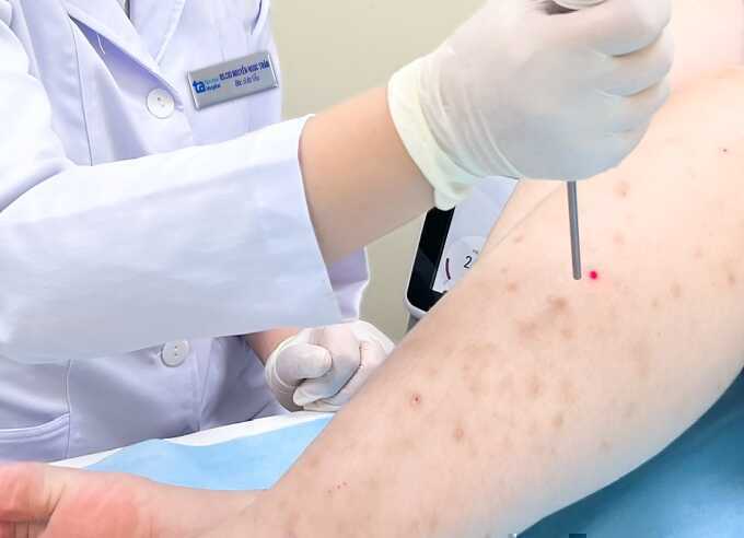 Viêm da sau tẩy lông