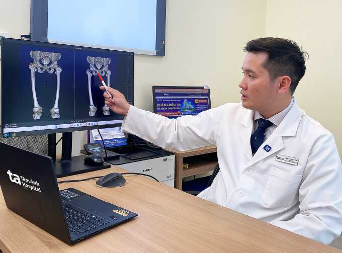 Sau thay khớp có gây cảm giác vướng ở chân không?
