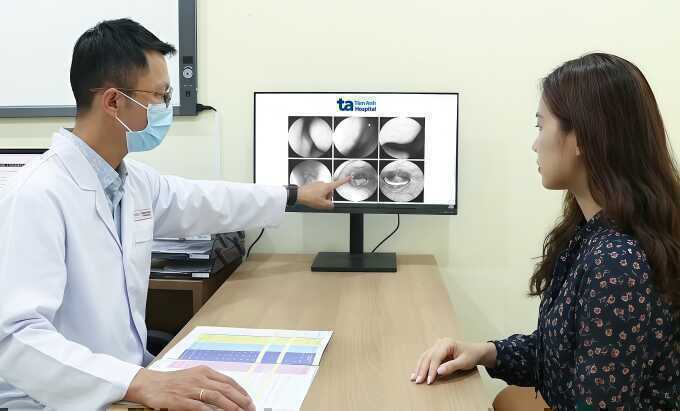 Sỏi amidan là gì?