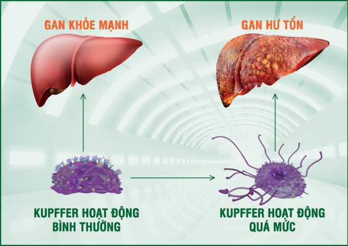 6 nguyên nhân gây tăng men gan thường gặp