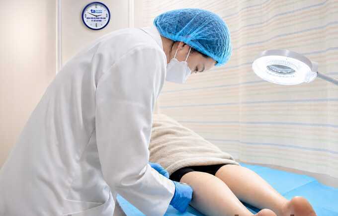 Tiêm botox thu nhỏ bắp chân