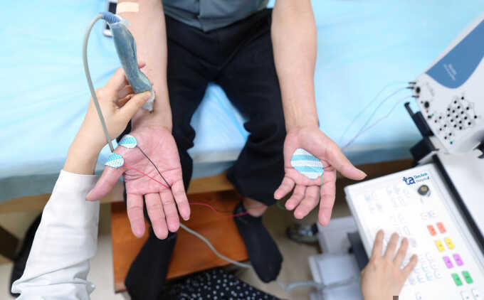 Run tay thường xuyên có phải dấu hiệu Parkinson?