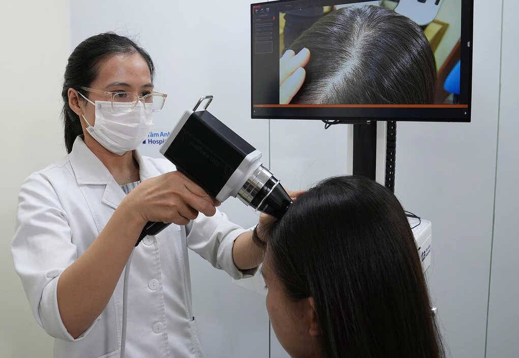 Điều trị rụng tóc sau sinh như thế nào