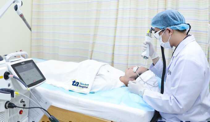 Da nhạy cảm có nên triệt lông bằng laser?