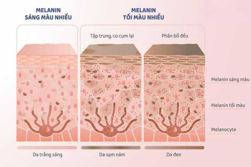 Ba lầm tưởng về sắc tố da melanin