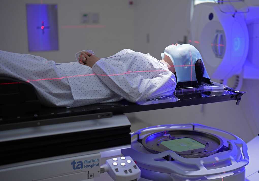 Xạ trị não có làm giảm trí nhớ?