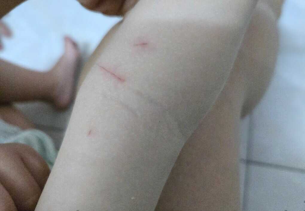 Bị chỉ trích khi đắn đo tiêm dại cho con