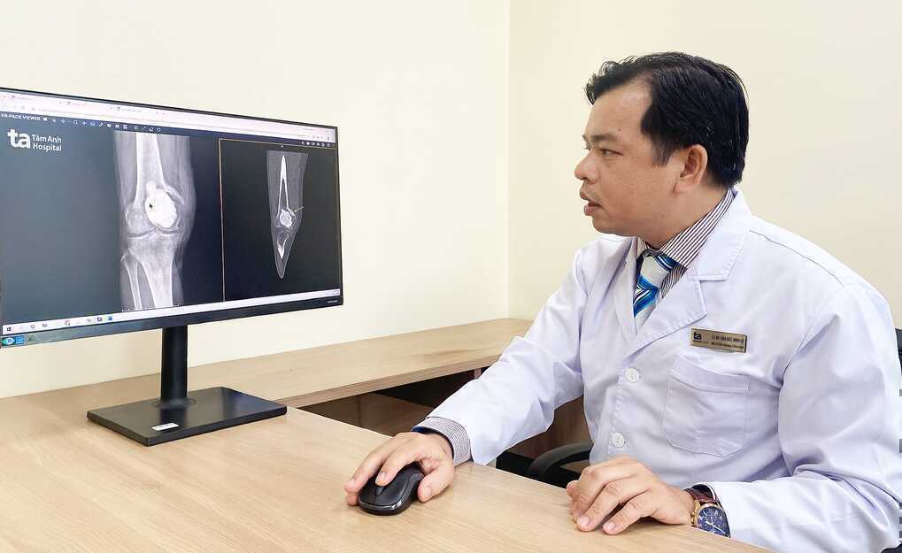 U phá hủy xương khớp gối người đàn ông