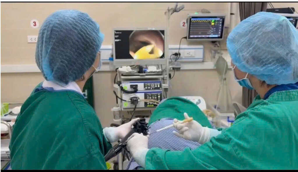 Phát hiện sán dây 1,2m trong ruột người đàn ông có thói quen ăn thịt bò tái
