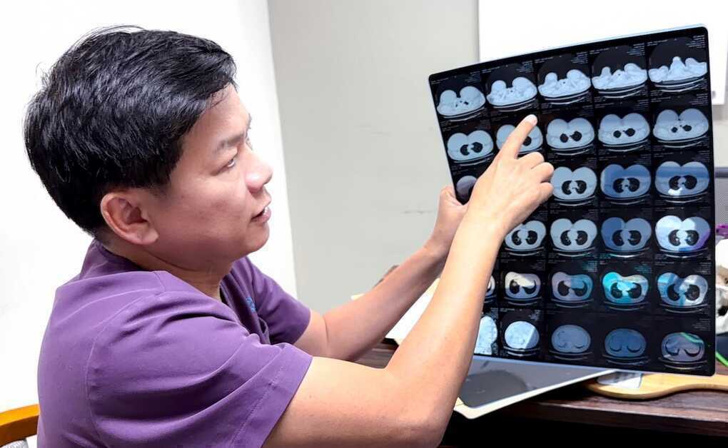 Vòng một phình to 115 cm sau 20 năm tiêm `mỡ nhân tạo`