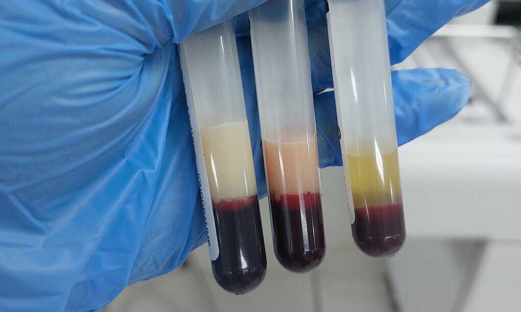 Nhập viện cấp cứu sau khi uống thuốc `ba đời` thải độc gan