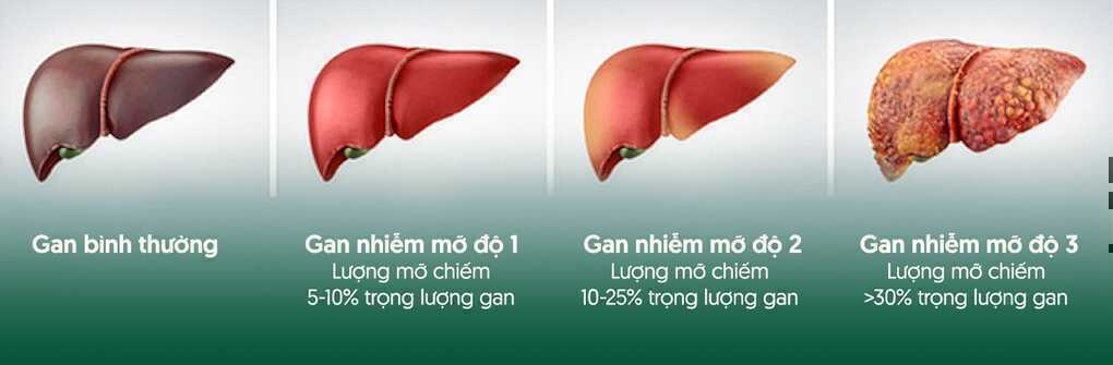 Tiến trình gan nhiễm mỡ